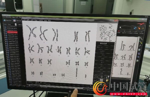 详解染色体易位的三种类型,引起原因除辐射外还有...(图1) 详解染色体易位的三种类型,引起原因除辐射外还有...(图1)