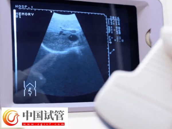 柳州试管婴儿排名上线，市妇幼勇夺榜首