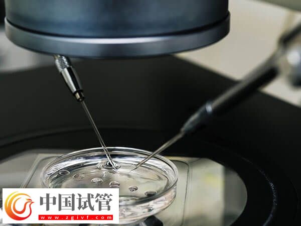 绵阳市中心医院助孕全程开销汇总,检查到手术至少3w(图1) 绵阳市中心医院助孕全程开销汇总,检查到手术至少3w(图1)
