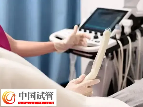 为什么试管婴儿移植前做tct检查(图1) 为什么试管婴儿移植前做tct检查(图1)