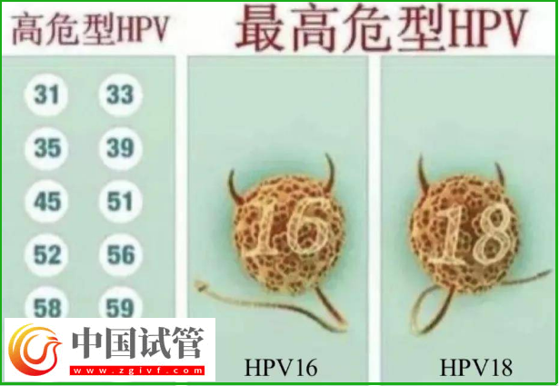 通过hpv报告单图片怎么判断自己是正常的呢？(图3)