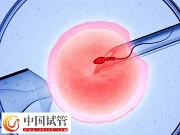 没有子宫能生孩子吗(图5) 没有子宫能生孩子吗(图5)
