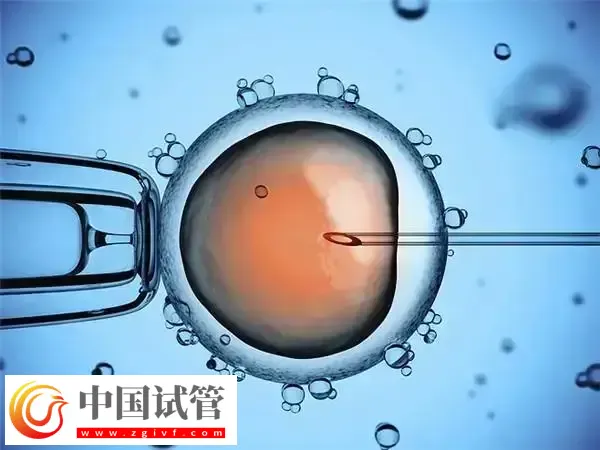 山西省儿童医院试管婴儿哪个医生成功率高