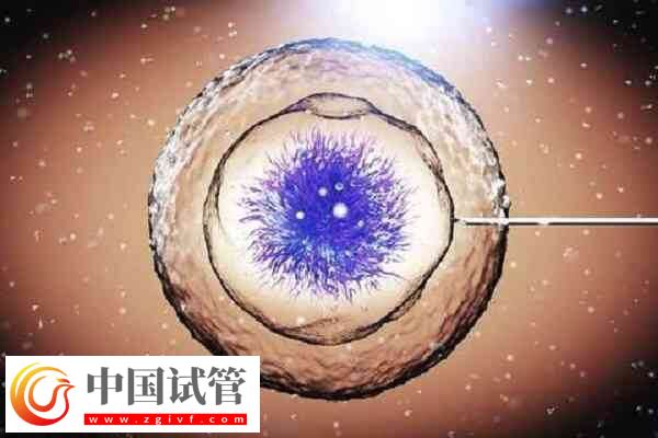 一代试管婴儿受精失败精卵不结合的原因有哪些?(图1) 一代试管婴儿受精失败精卵不结合的原因有哪些?(图1)