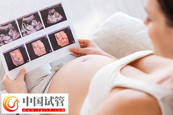 孕检单怎么看男女 生男生女(图1) 孕检单怎么看男女 生男生女(图1)