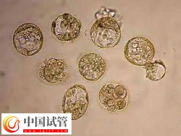 囊胚移植后头晕乏力的原因是什么(图1) 囊胚移植后头晕乏力的原因是什么(图1)
