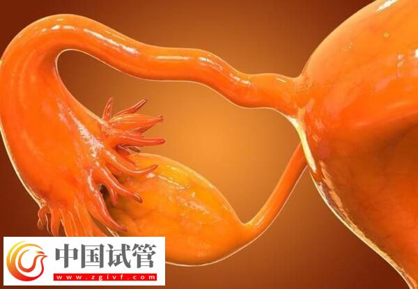 先天性卵巢发育不全可不可以做试管婴儿(图1) 先天性卵巢发育不全可不可以做试管婴儿(图1)