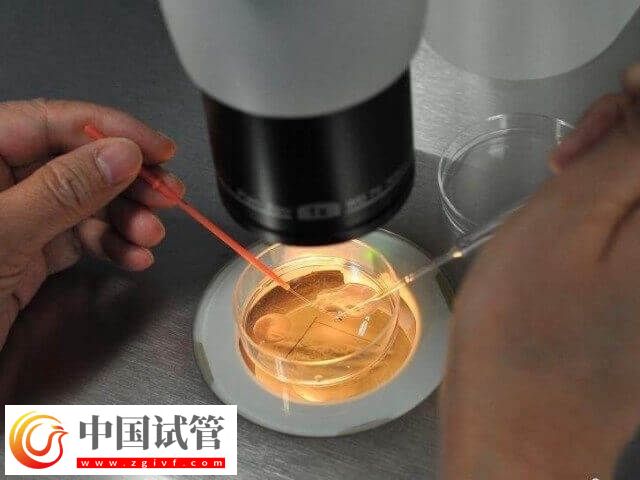 胚胎培养液对试管婴儿有没有影响(图1) 胚胎培养液对试管婴儿有没有影响(图1)