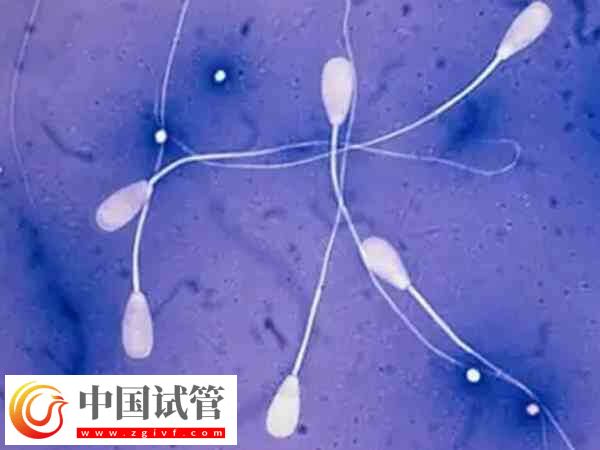 弱精少精是什么原因导致的