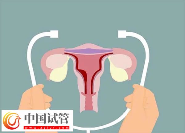 子宫内膜薄做试管婴儿能不能成功
