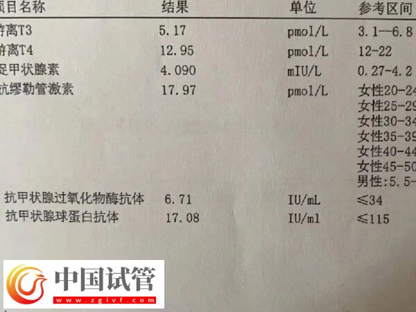 为什么41岁女人做试管婴儿会失败?背后真相大揭秘(图1) 为什么41岁女人做试管婴儿会失败?背后真相大揭秘(图1)