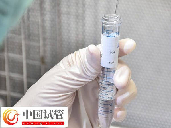 兰州供卵做三代试管婴儿费用多少