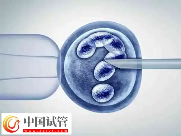 昆明做供卵试管婴儿有什么要求