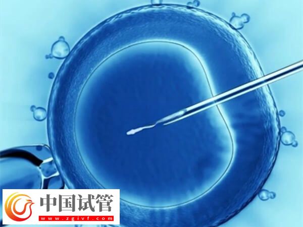 徐州试管成功率高不高