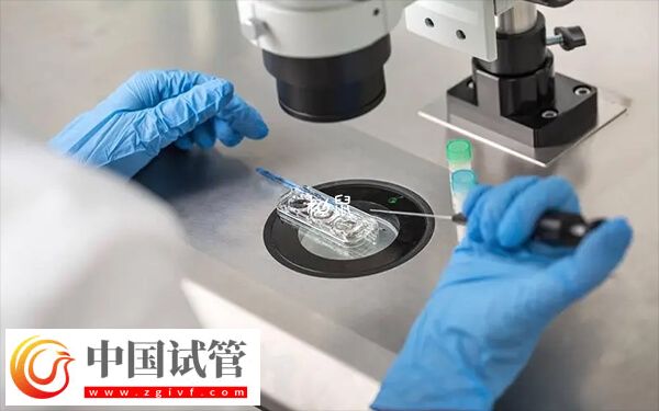高龄做第二代试管有没有风险(图1) 高龄做第二代试管有没有风险(图1)