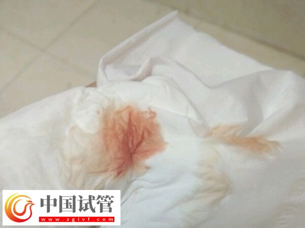 移植着床会有什么反应(图1)
