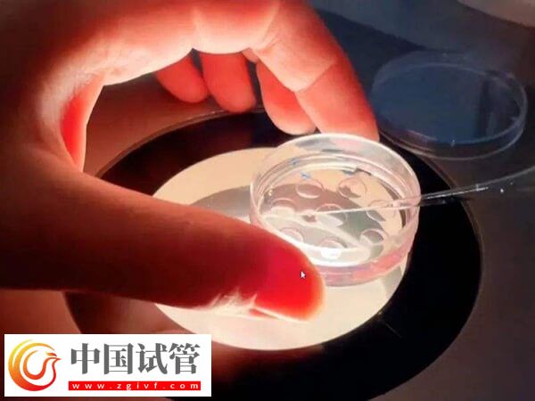 试管进入周期要做什么(图1) 试管进入周期要做什么(图1)