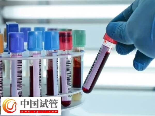 做试管前要做什么检查(图1)