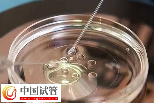 10个人做试管几个能成功(图1)
