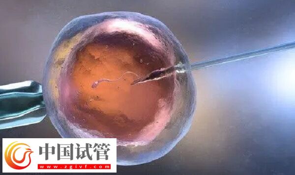 雌激素高做试管前怎么办(图1) 雌激素高做试管前怎么办(图1)
