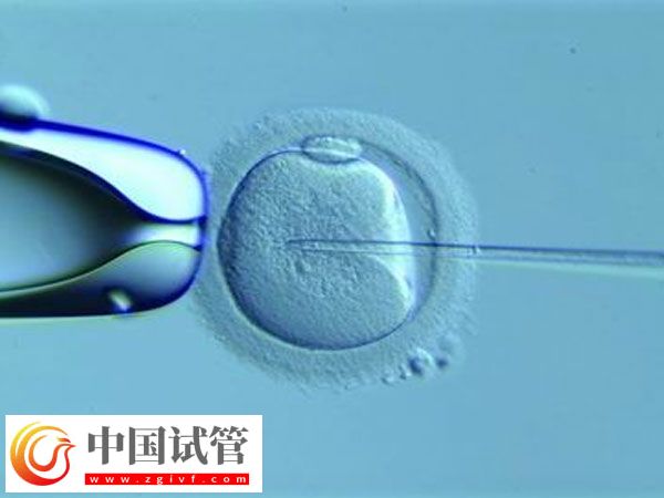 泰国试管婴儿能活多久