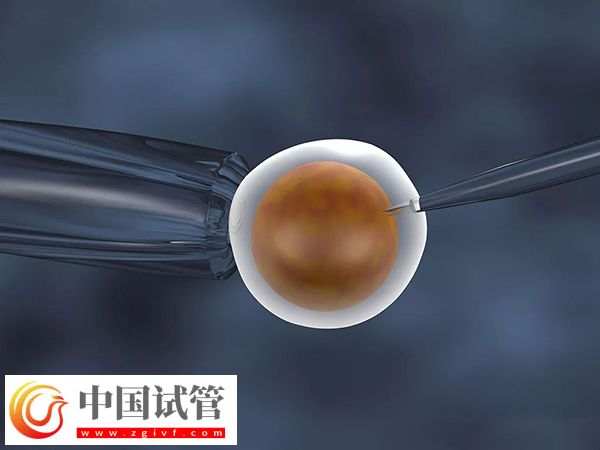 在西班牙做试管婴儿需要什么条件(图3)