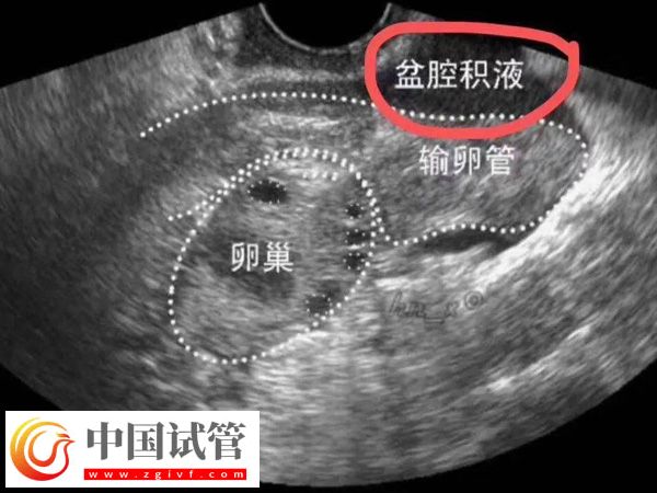 在西班牙做试管婴儿需要什么条件(图4)