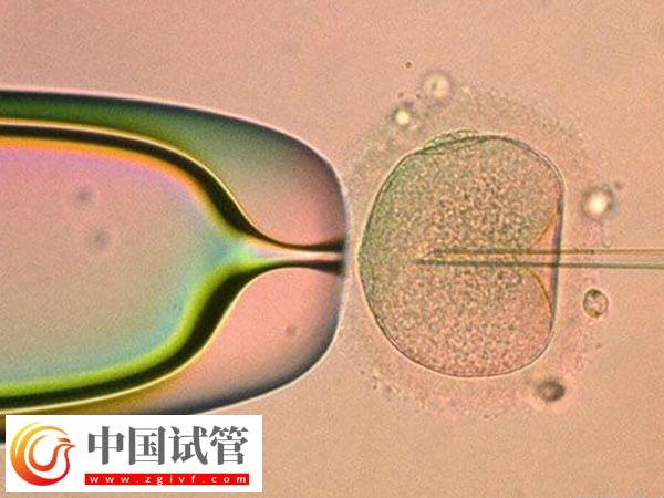 前往加拿大做试管的要求(图1) 前往加拿大做试管的要求(图1)
