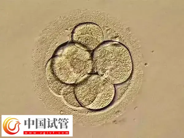 移植鲜胚好还是移植囊胚好(图1) 移植鲜胚好还是移植囊胚好(图1)