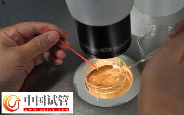 试管前如何调理身体(图1) 试管前如何调理身体(图1)