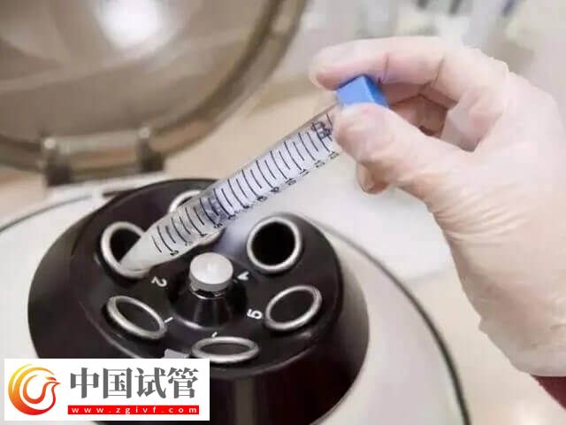 试管睾丸穿刺取精要穿刺几次(图2)