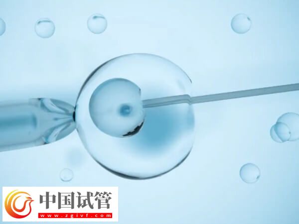 试管睾丸穿刺取精要穿刺几次(图1)
