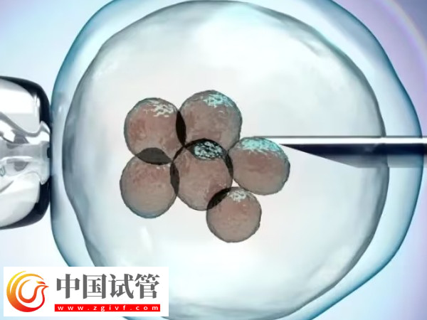 湘雅和武汉试管哪家好