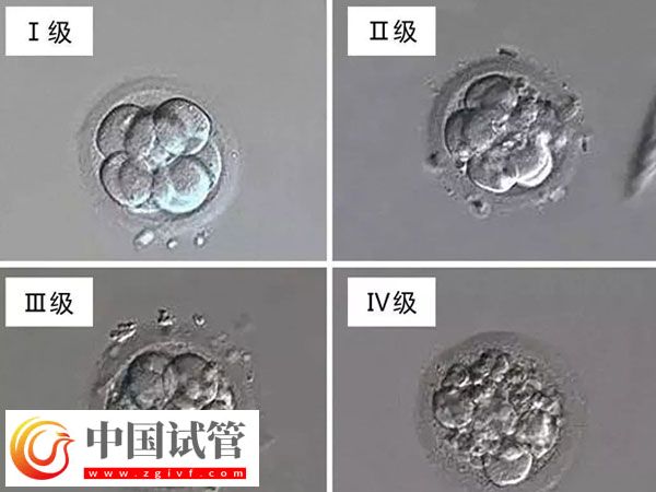 南昌妇幼做试管医生排名(图2)