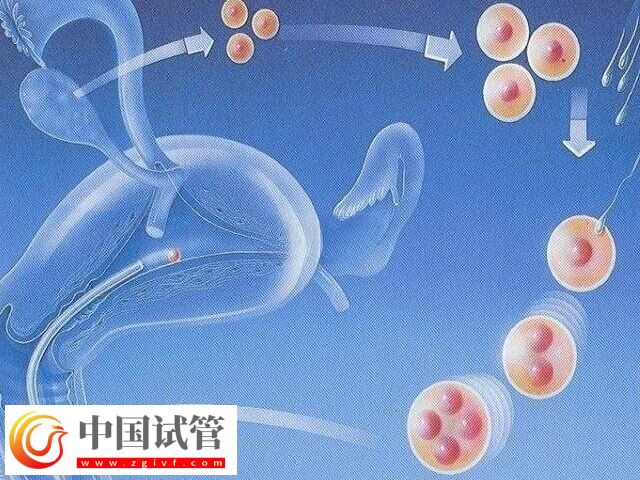 试管婴儿不适用于哪些人(图1)