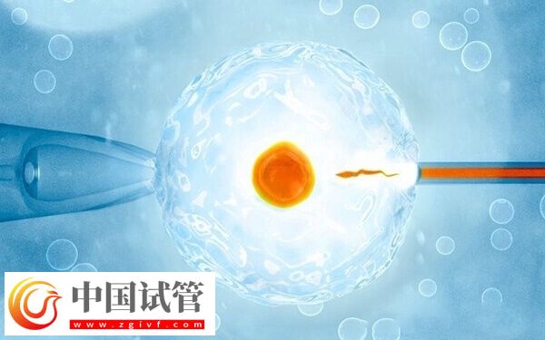 做试管婴儿为什么要降糖(图1) 做试管婴儿为什么要降糖(图1)