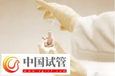 济南做试管婴儿成功率较高的医院前三名：济南第一人民医院排第一