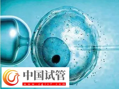 北京做供卵试管不用排队的医院有哪些?这些公立医院纷纷上榜(图3) 北京做供卵试管不用排队的医院有哪些?这些公立医院纷纷上榜(图3)