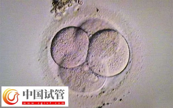 女性fsh高做试管能不能配出高质量胚胎(图3)