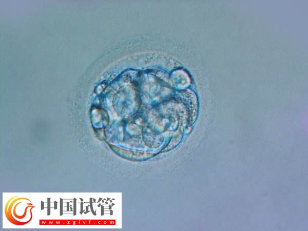胚胎移植后哪些反应是着床了(图1)