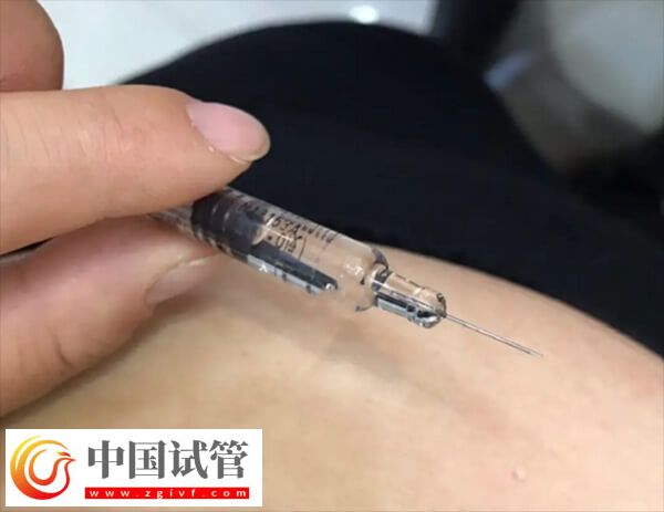 试管婴儿长方案和短方案哪个好(图1)