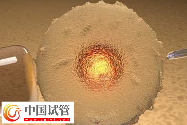 前往俄罗斯做试管合不合法