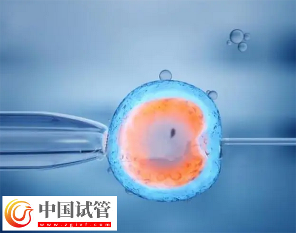 上海试管婴儿成功率
