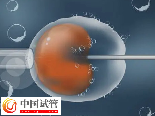 在义乌能不能做试管婴儿