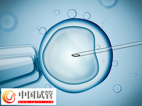 夫妻去美国做试管怎么选择医院