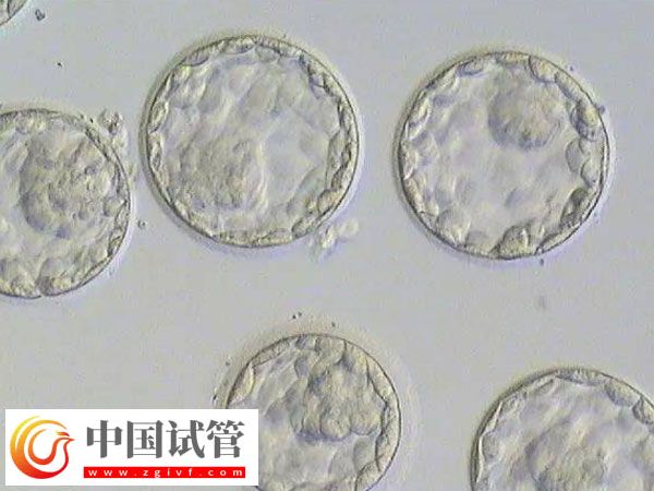 移植囊胚和三天胚胎是否一样