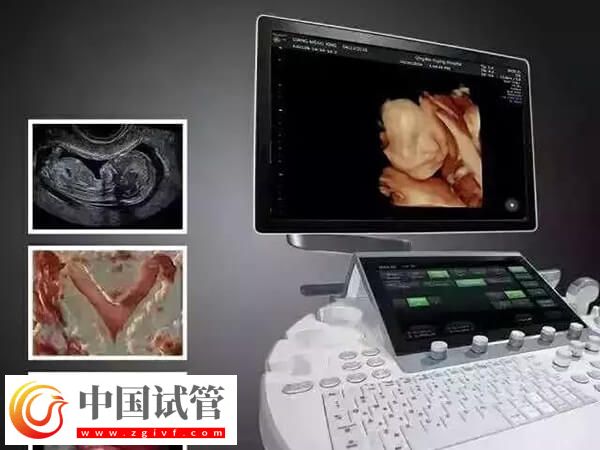 鹰潭公立三甲医院做一次四维彩超多少钱？