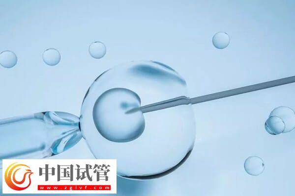 试管移植1个还是2个好(图1) 试管移植1个还是2个好(图1)