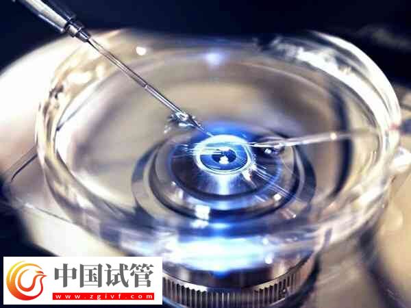 取卵后可以吃什么食物(图1) 取卵后可以吃什么食物(图1)