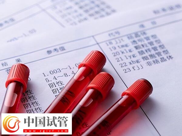 30岁促卵泡刺激素100多是怎么回事(图1)